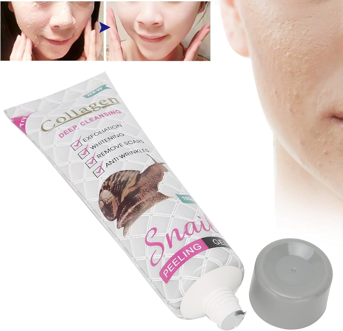 Gel Exfoliant 100 Ml Gel Exfoliant Acide Collagène Peau Nettoyage Des Pores De La Peau Enlèvement De La Peau Morte Nettoyage En Profondeur Du Visage Nettoyant Pour Le Visage Pour Une Peau plus Lisse
